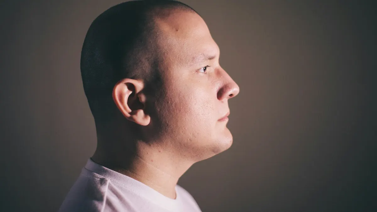 Piezo rinoplastika nədir? Ultrasəs texnologiyası ilə burun sümüyü korreksiyası