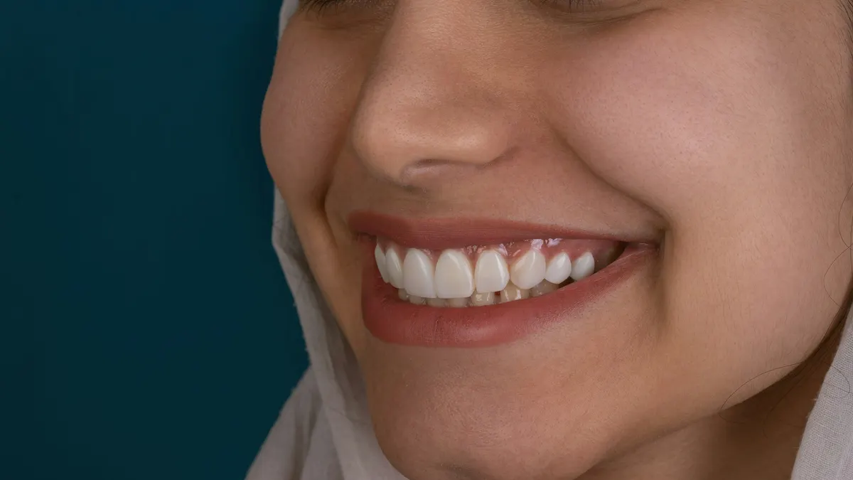 Veneer qulluğu: ömrünü uzatmaq üçün nə etməli, nədən qaçınmalı