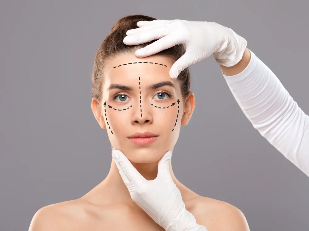Buxaq üzgermə (Submental lift): Çift çenədən qurtulmaq