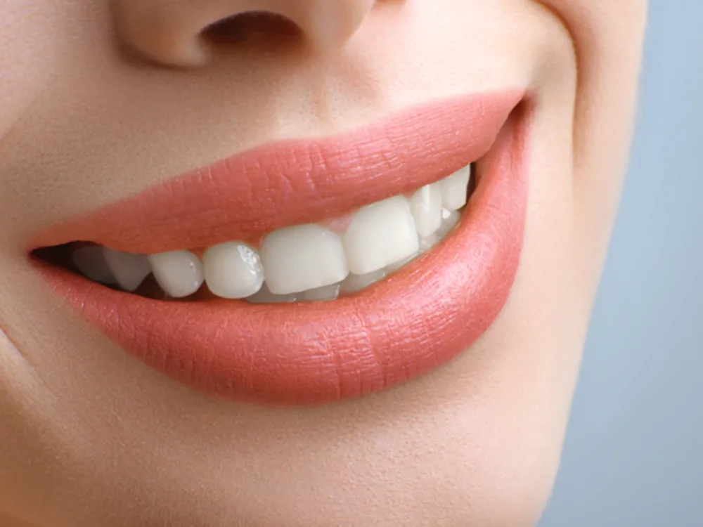 Hollywood Smile