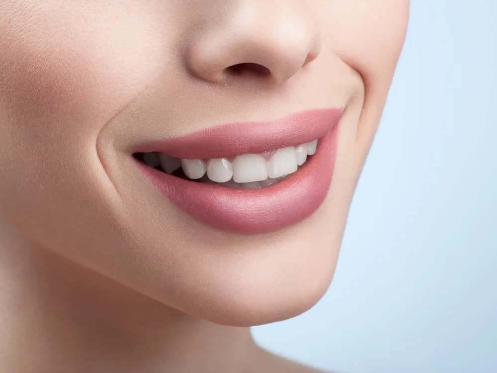 Hollywood Smile