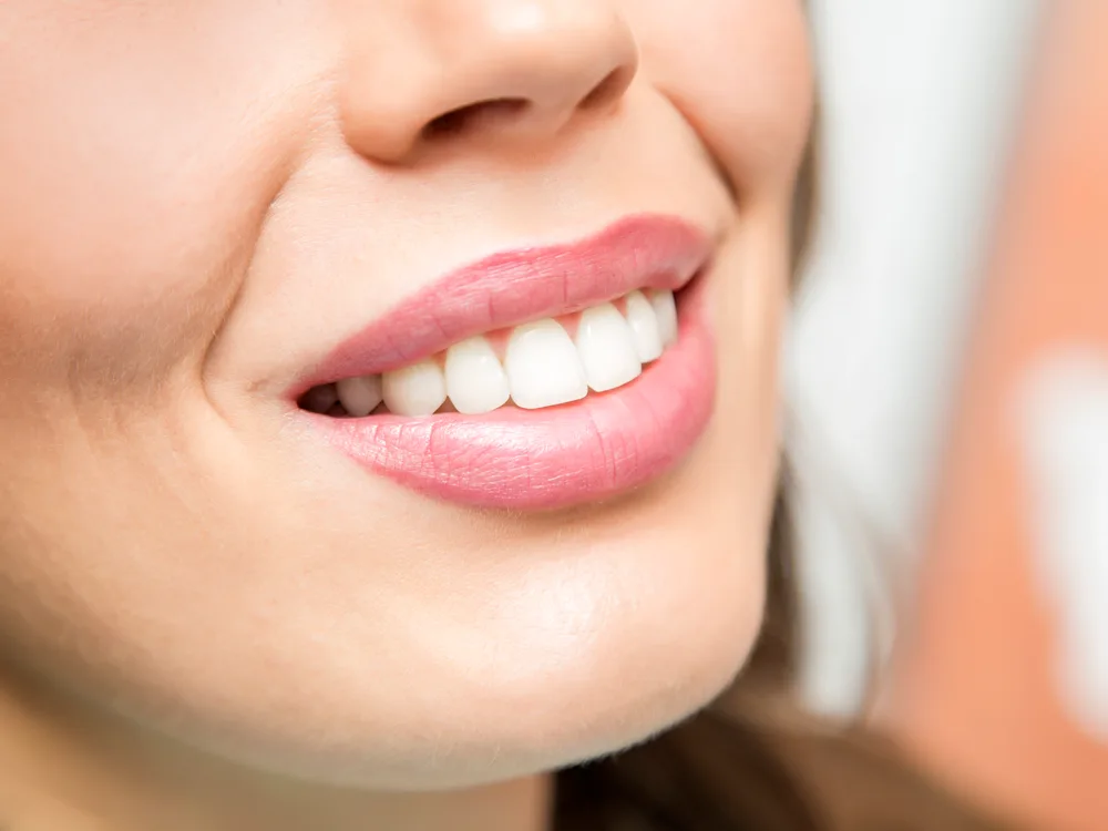 Hollywood Smile
