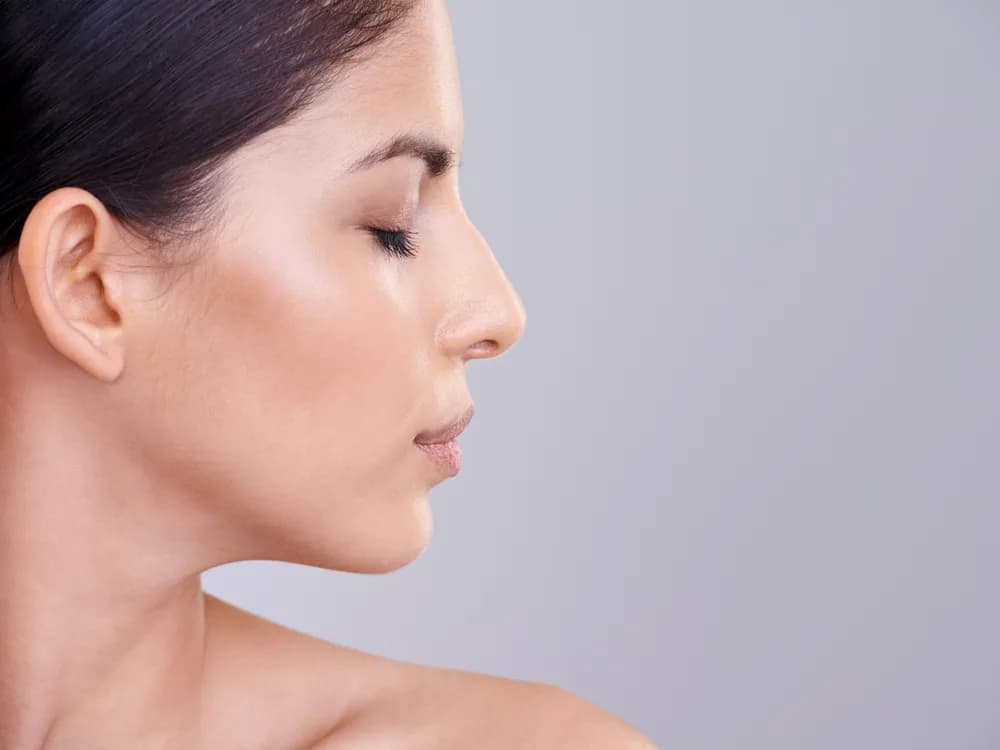 Rinoplastika