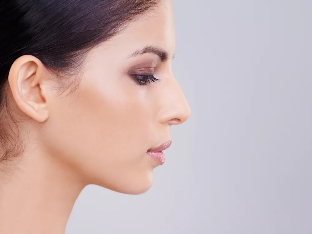 Rinoplastika